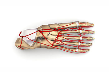 peripheral artery disease 